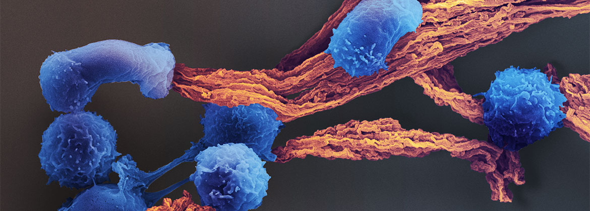 T-Cell in MPS Scaffold use to expand patient specific cells.