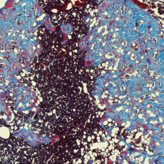 Histologic Image of Bone Marrow Cryogel 6 weeks after injection